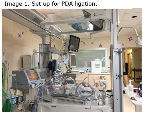 Image 1. Set up for PDA ligation